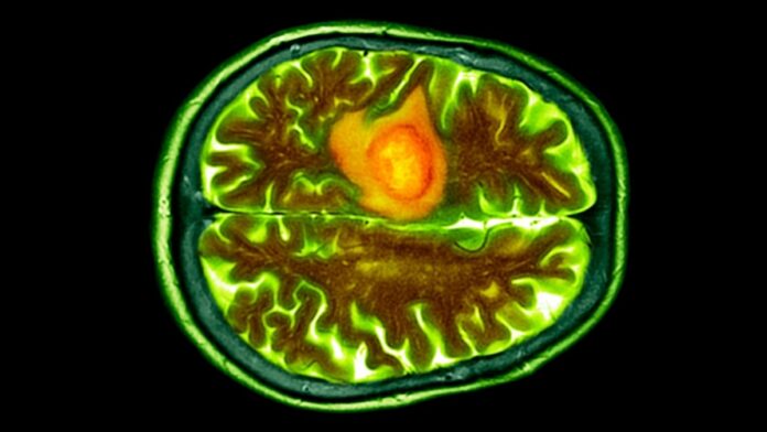 ed48f6d4-79aa-4d5c-a048-ba7c12107220