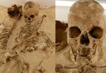 Стародавня ДНК виявила підлітка кам’яного віку з рідкісною генетичною карликовістю