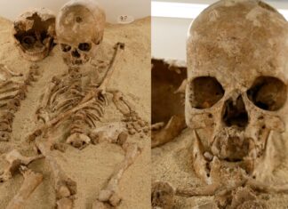 Древняя ДНК раскрывает подростка каменного века с редким генетическим карликовостью