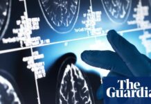 Новий огляд ставить під сумнів реальну ефективність препаратів від хвороби Альцгеймера