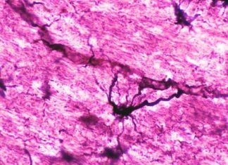 Immune Resets, 15-Year Cures